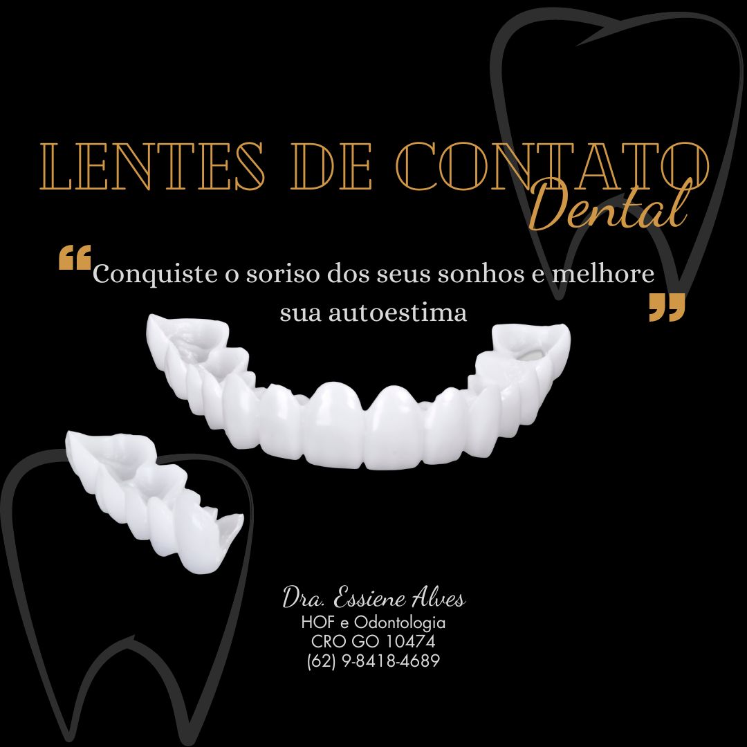FACETAS PORCELANA GOIANIA GOIAS