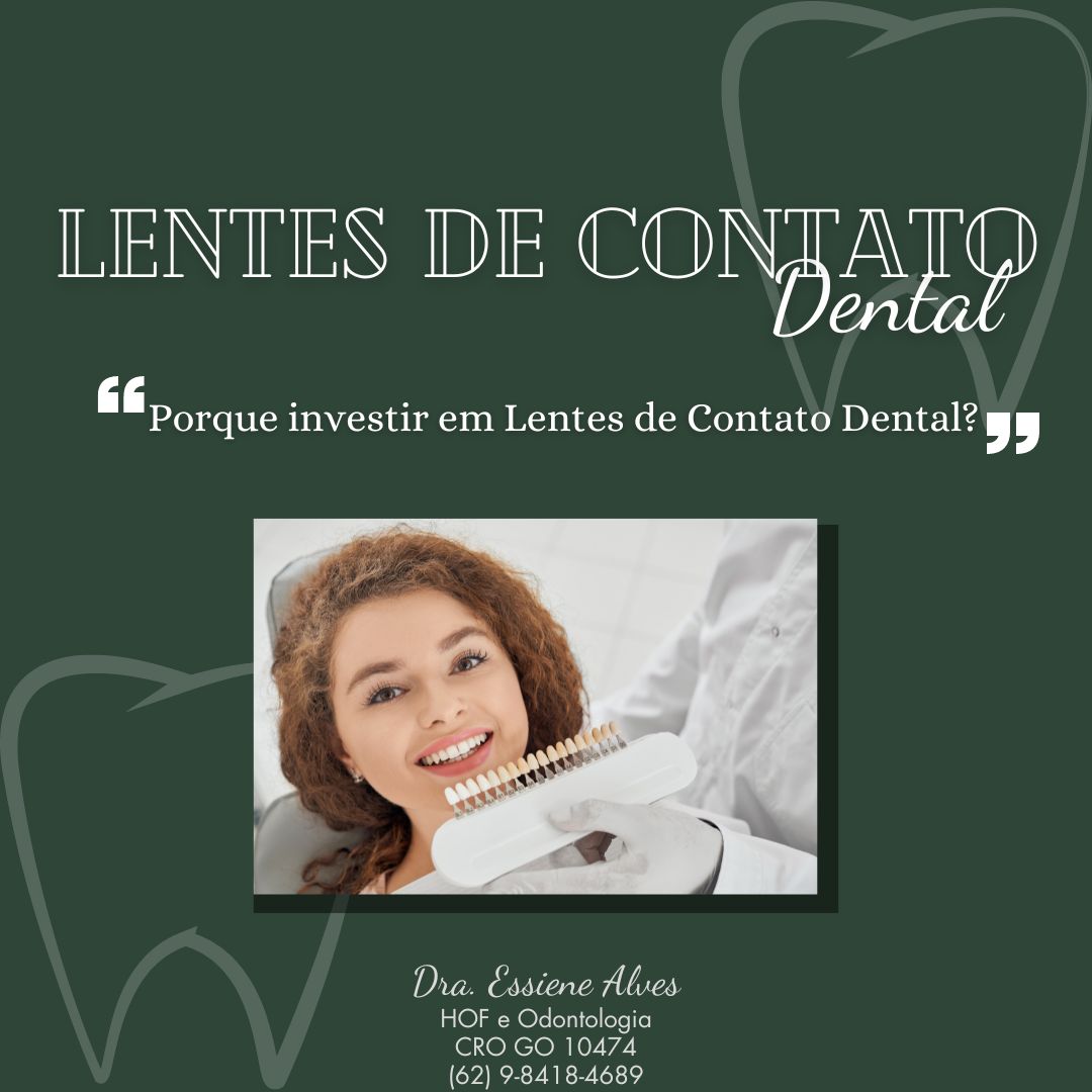 FACETAS PORCELANA GOIANIA GOIAS