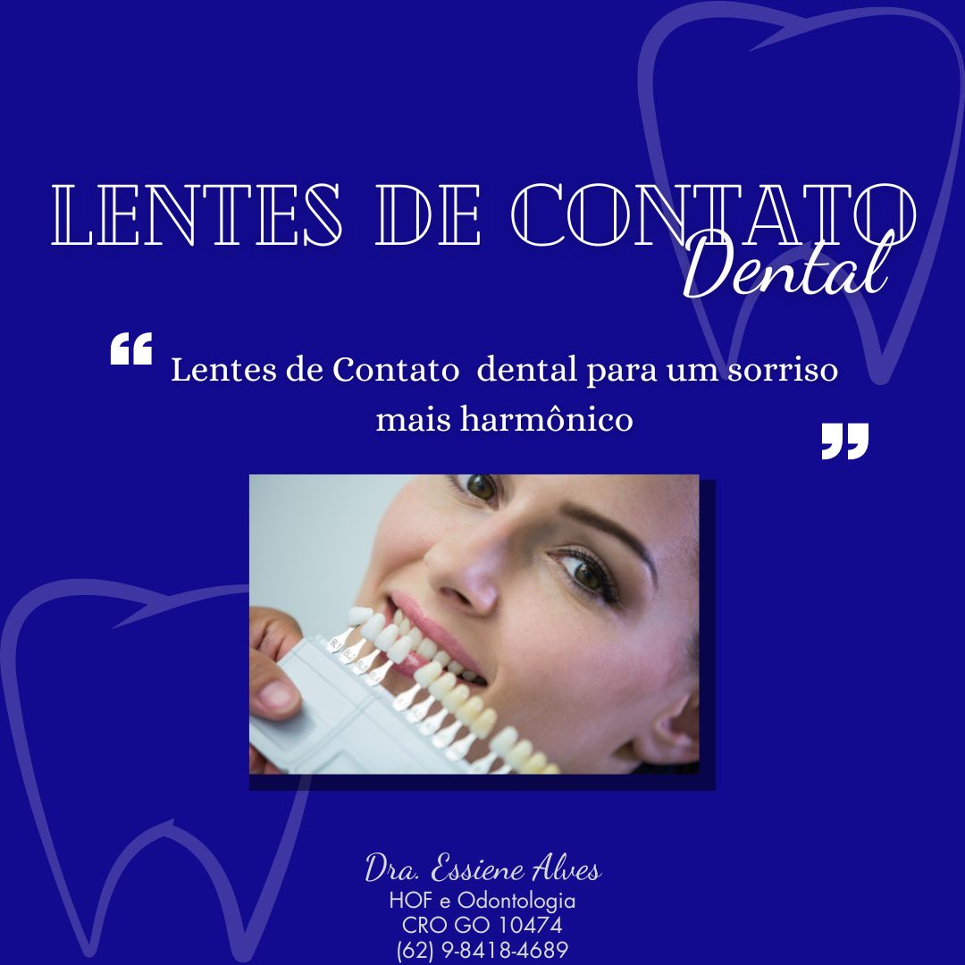FACETAS PORCELANA GOIANIA GOIAS