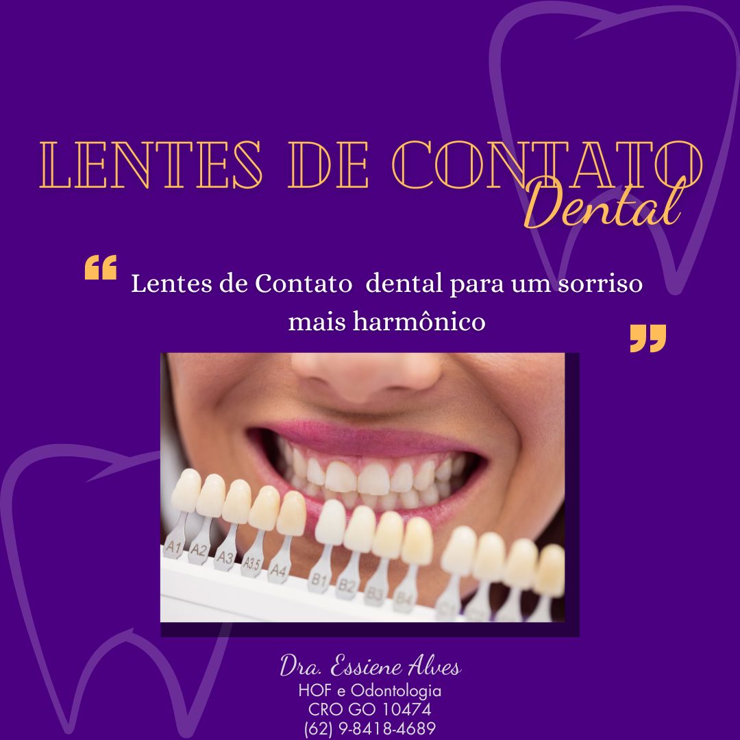 FACETAS PORCELANA GOIANIA GOIAS
